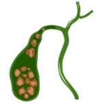 vesícula
