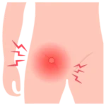 Especialista en Cirugía de Hernias en Oaxaca