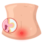 Especialista en Cirugía de Hernias en Oaxaca