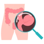 Especialista en Cirugía de Hernias en Oaxaca