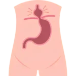 Cirugía de Hernia en Ciudad Juárez