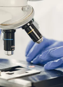 liposarcoma Especialista en Lipomas en Oaxaca